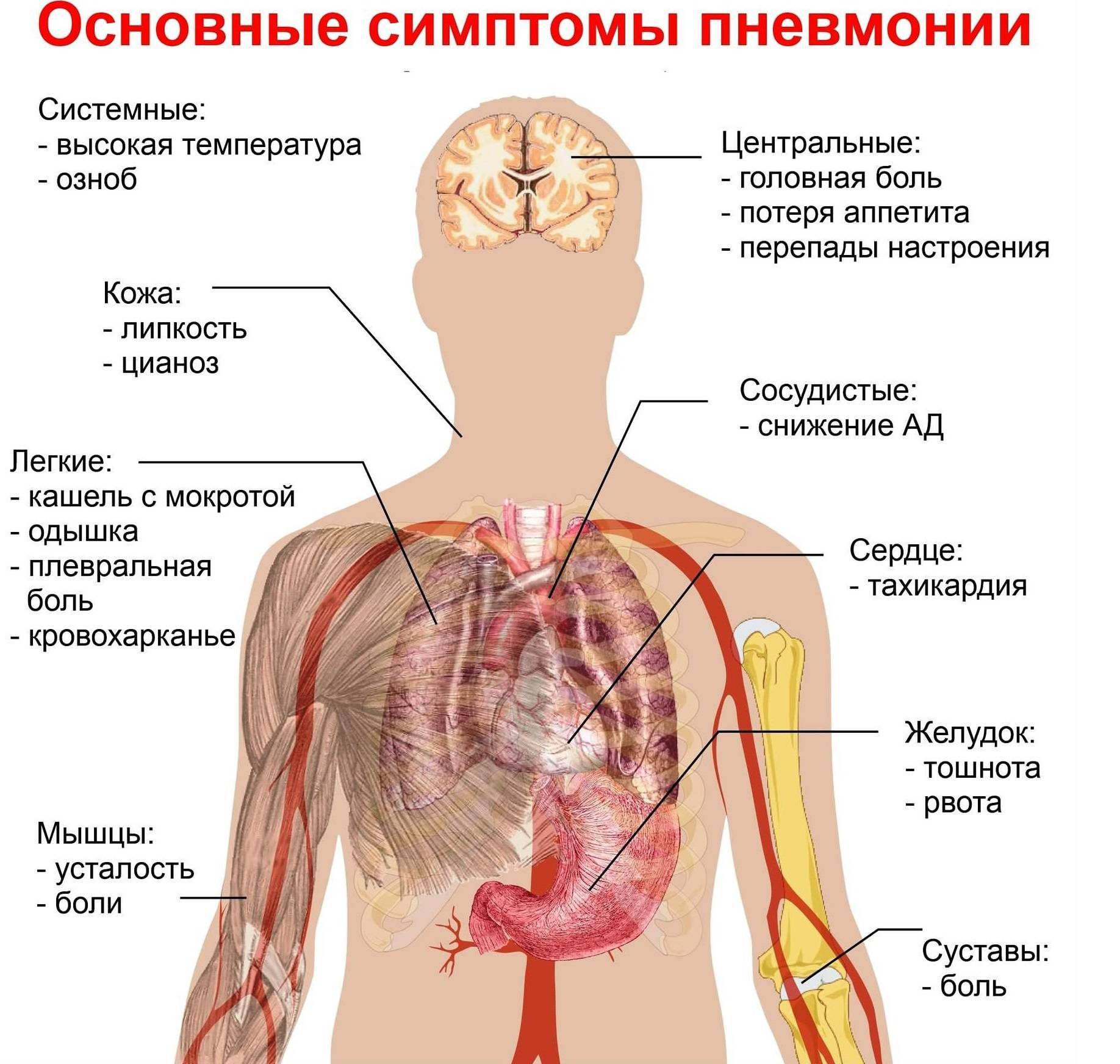 Пневмония у дошколят: как правильно распознать симптомы и признаки воспаления легких у детей от 4 до 7 лет