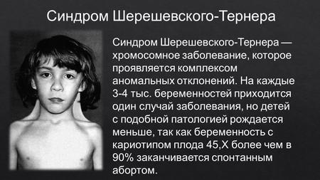 Тернера синдром — большая медицинская энциклопедия