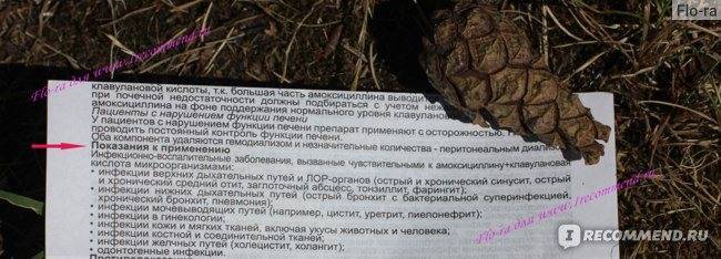Цитробактер: описание бактерий, симптомы и лечение заболеваний