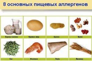 Как проявляется аллергия на киви: причины, симптомы, лечение