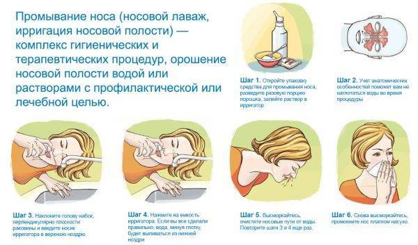 Причины появления выделений из носа