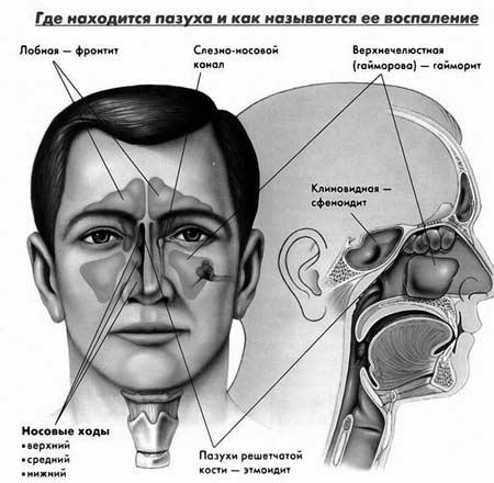 Фронтит: признаки, причины и способы лечения