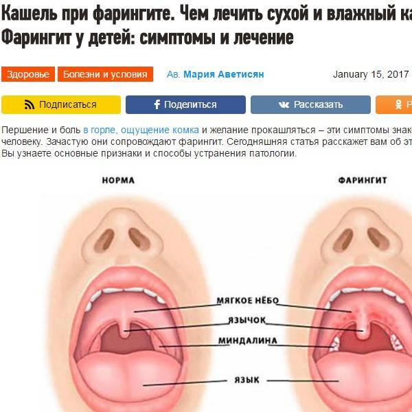 Причины постоянного першения в горле и покашливания