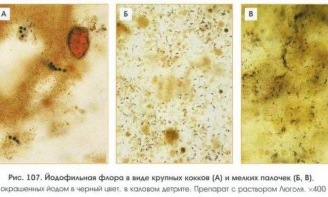 Йодофильная флора в копрограмме - опасные бактерии
