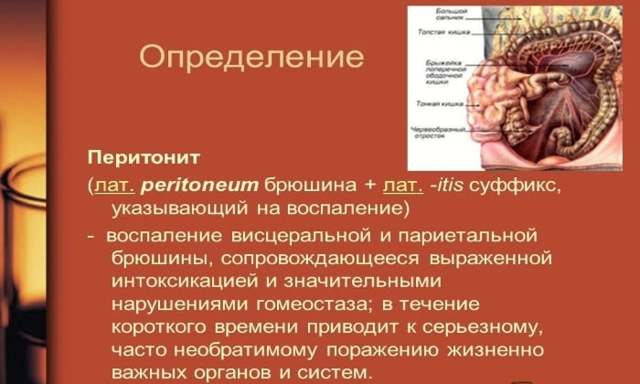 Причины и симптомы заворота кишок у детей. как распознать, лечение