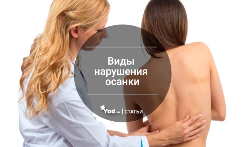 Как лечить сколиоз у детей?