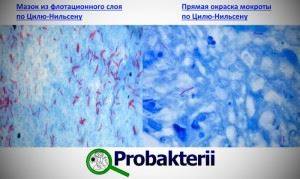 Каковы тинкториальные свойства микроорганизмов?