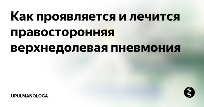 Полисегментарная пневмония: правосторонняя и левосторонняя, причины развития, лечение