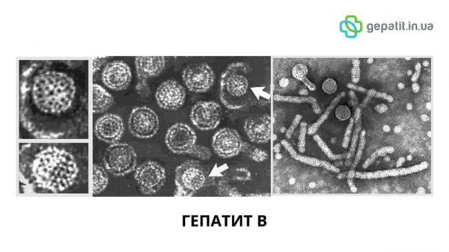 Гепатит с