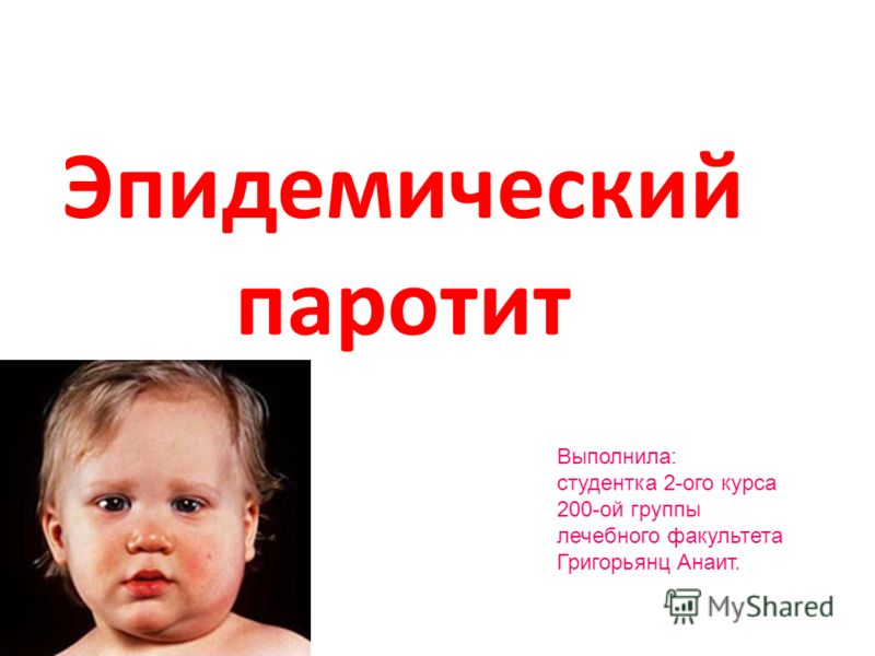 Паротит у детей - симптомы болезни, профилактика и лечение паротита у детей, причины заболевания и его диагностика на eurolab