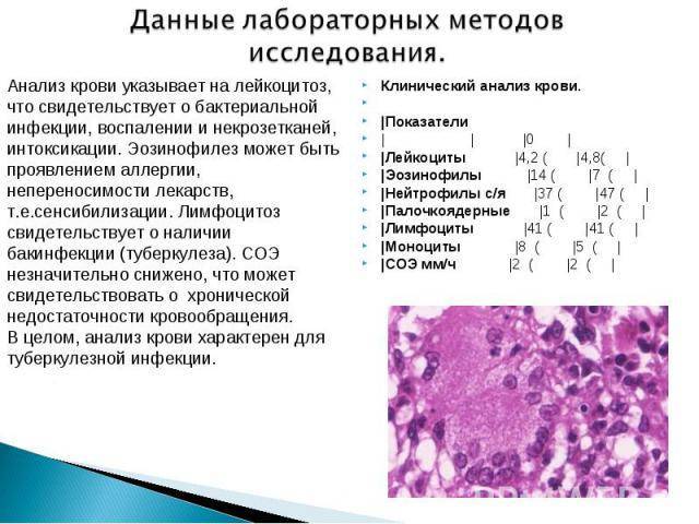 Анализ крови на туберкулез: показатели при общем анализе, расшифровка результатов