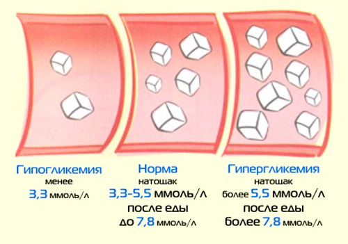Нормальный уровень глюкозы в крови у мужчин, отклонения, лечение
