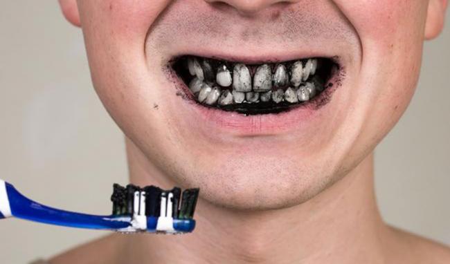 Отбеливание зубов с помощью соды, перекиси, лимона и пасты