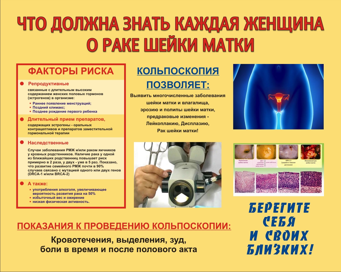 Рак шейки матки: статистика