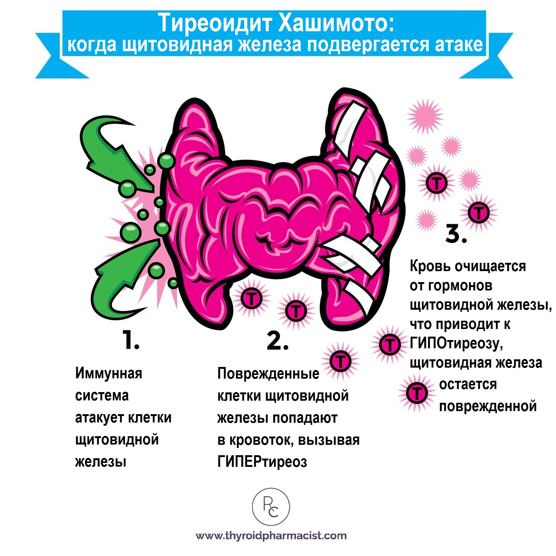Причины хронического тиреоидита