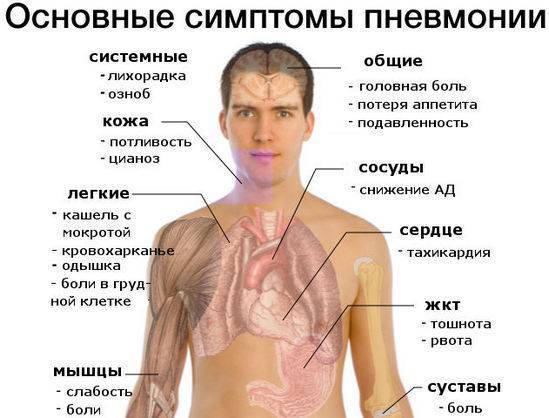 Сегментарная пневмония