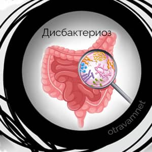 Пищевые токсикоинфекции