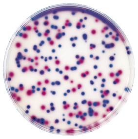 Escherichia coli в моче норма