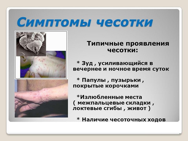 Бензилбензоат эмульсия