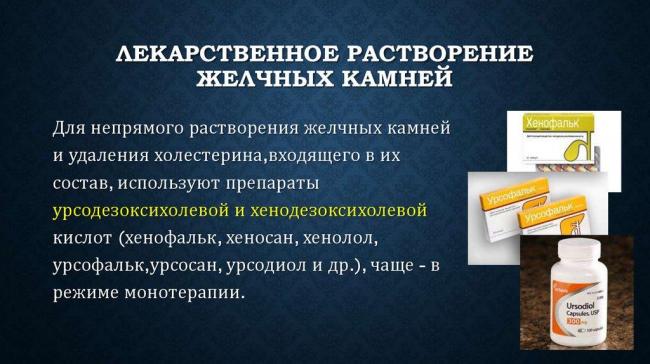 Желчнокаменная болезнь -симптомы и способы лечения