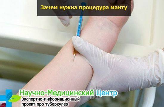 Оценка результатов диаскинтеста у взрослых и что делать если положительный у ребенка