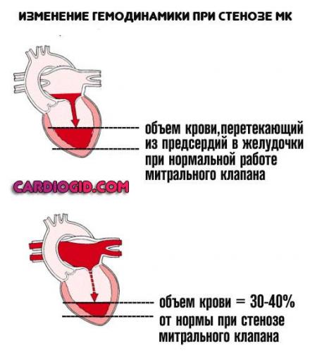 Умирают ли от бронхиальной астмы?
