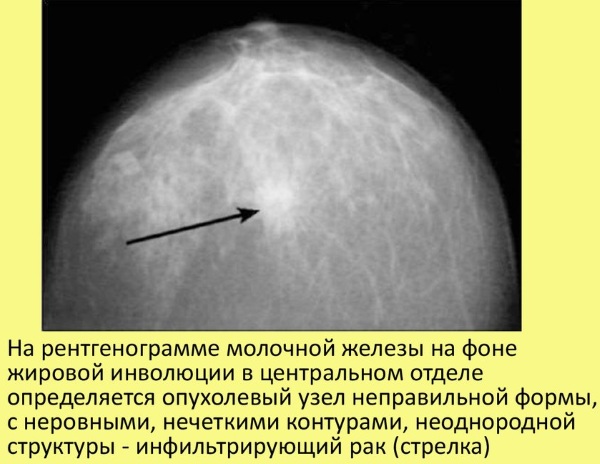 Диета для груди