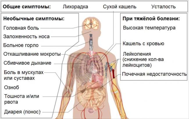 Врожденная пневмония у новорожденных