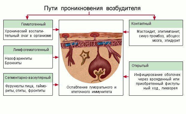 С какими заболеваниями дифференцировать менингит