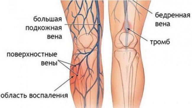 Эффективность дыхательной гимнастики при бронхиальной астме