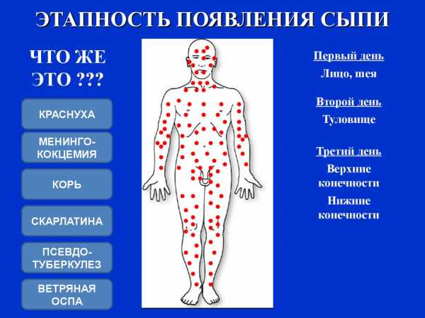 Противопоказания к проведению вакцинации. родителям на заметку. специалисты о прививках