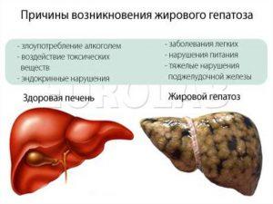 Диета при ожирении печени – что можно кушать, что нельзя