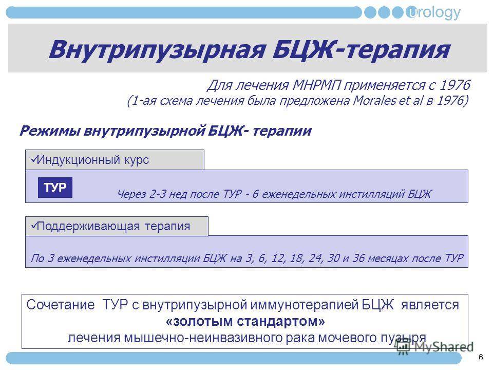 Применение бцж-терапии при лечении рака мочевого пузыря, особенности метода