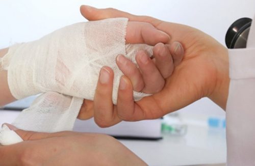 Последствия ожог медузы