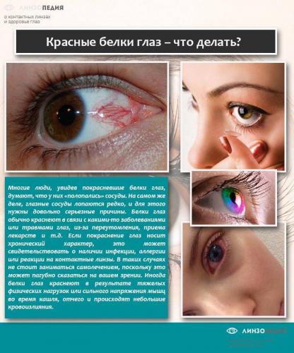Покраснение глаз