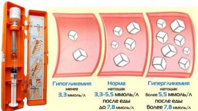 Норма сахара в крови у женщин после 40-50-60-70 лет