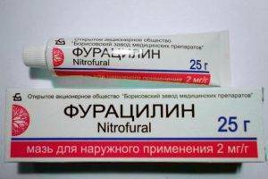 Эписклерит глаза, в том числе хронический у детей и взрослых, капли