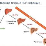 Лечение хронического гепатита C