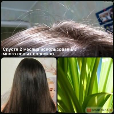 «эвалар», «эксперт волос»: отзывы специалистов