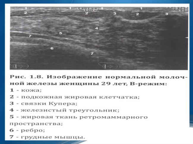 Уплотнение в молочной железе у женщин: причины и лечение