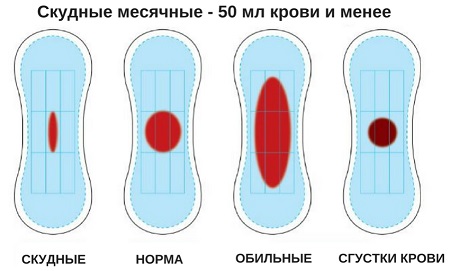 Что такое пролиферативный эндометрий?