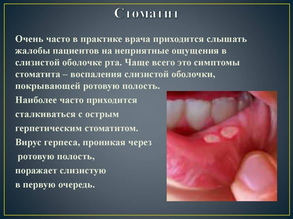 Признаки трахеита