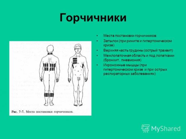 Можно ли ставить горчичники при пневмонии, чем полезны и как проводить процедуры