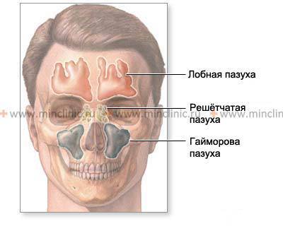 Фронтит