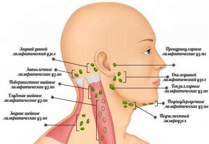Причины воспаления лимфоузлов за ушами и методы лечения