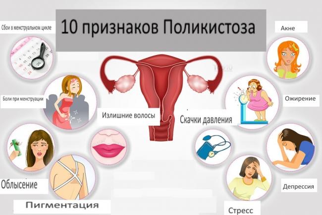 Что такое поликистоз яичников или спкя: симтомы, причины и лечение