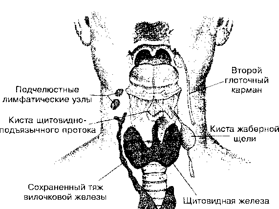 Шишки под кожей на теле