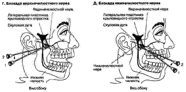 Тройничный нерв – что это такое, и чем опасно его поражение?