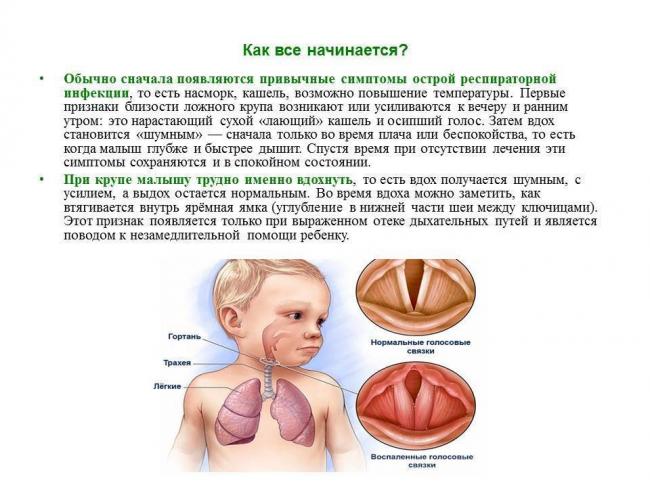 Причины и особенности лечение кашля по утрам