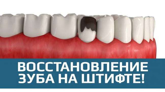 Восстановление коронковой части зуба — можно ли нарастить коронку, цены, фото